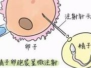 42岁试管晚不晚？42岁做试管还不算太晚