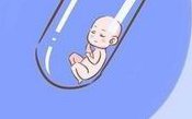 问一下医生做试管婴儿前要先做哪些检查？