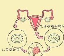 排卵有问题还可以做试管婴儿吗？