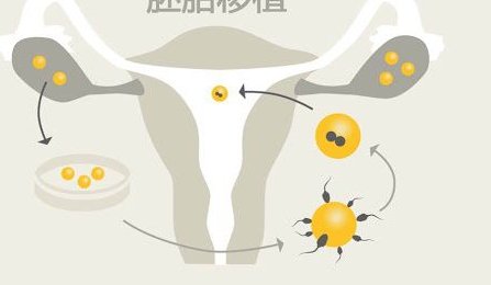 江苏省中医院洗精费用多少钱？试管婴儿移植成功后检查流程有哪些？